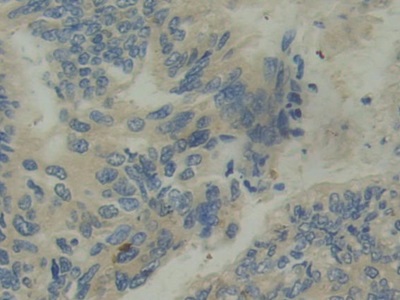 Monoclonal Antibody to Interleukin 12A (IL12A)