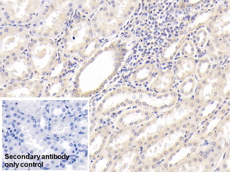 Monoclonal Antibody to Interleukin 18 (IL18)