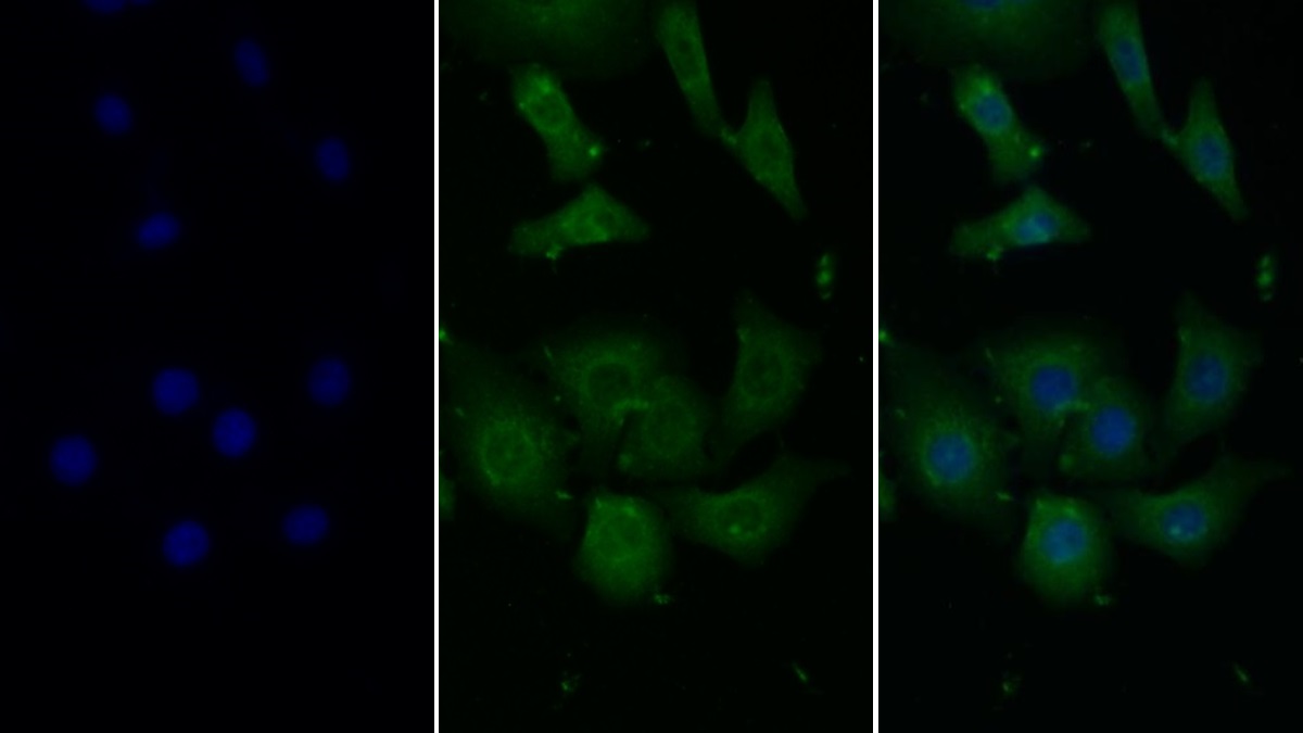 Monoclonal Antibody to Monocyte Chemotactic Protein 1 (MCP1)