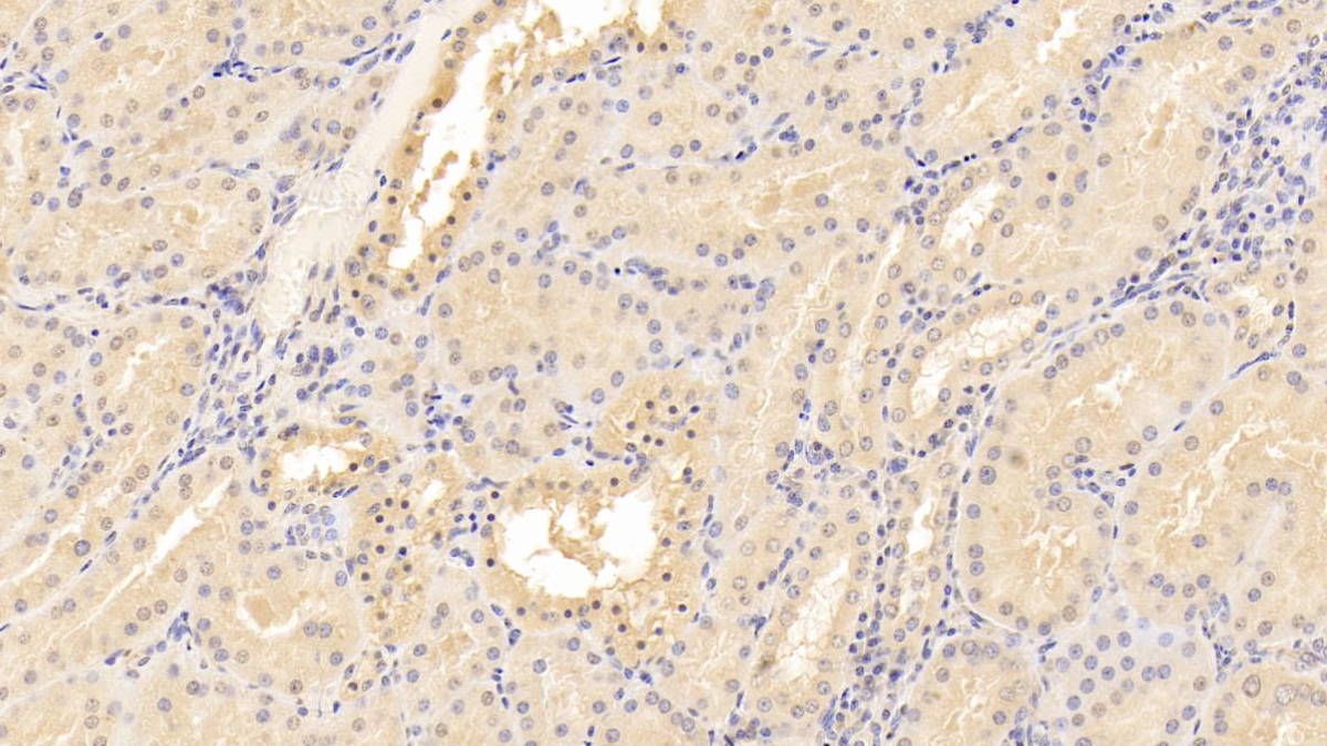 Monoclonal Antibody to Cluster Of Differentiation 40 Ligand (CD40L)