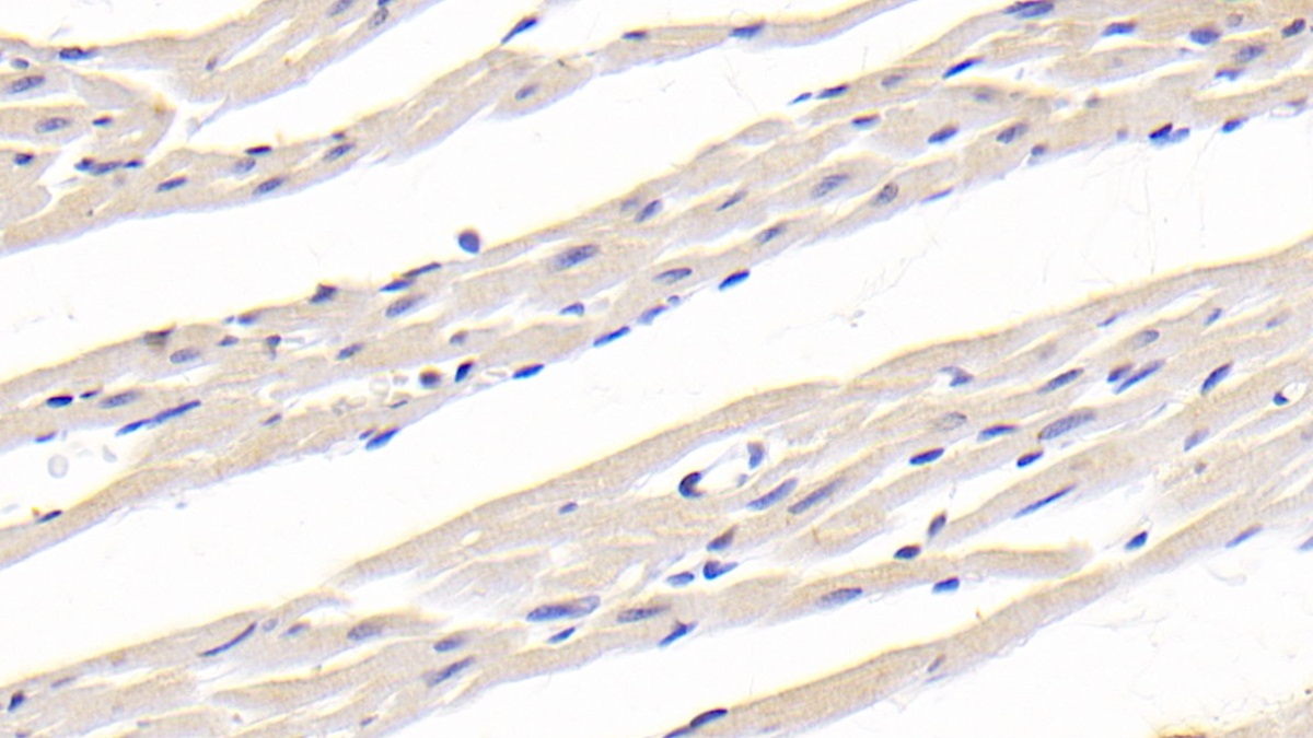 Monoclonal Antibody to Cluster Of Differentiation 40 Ligand (CD40L)