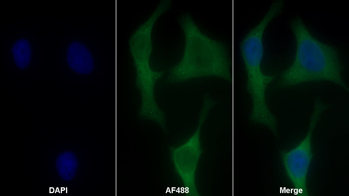 Monoclonal Antibody to Stem Cell Factor Receptor (SCFR)