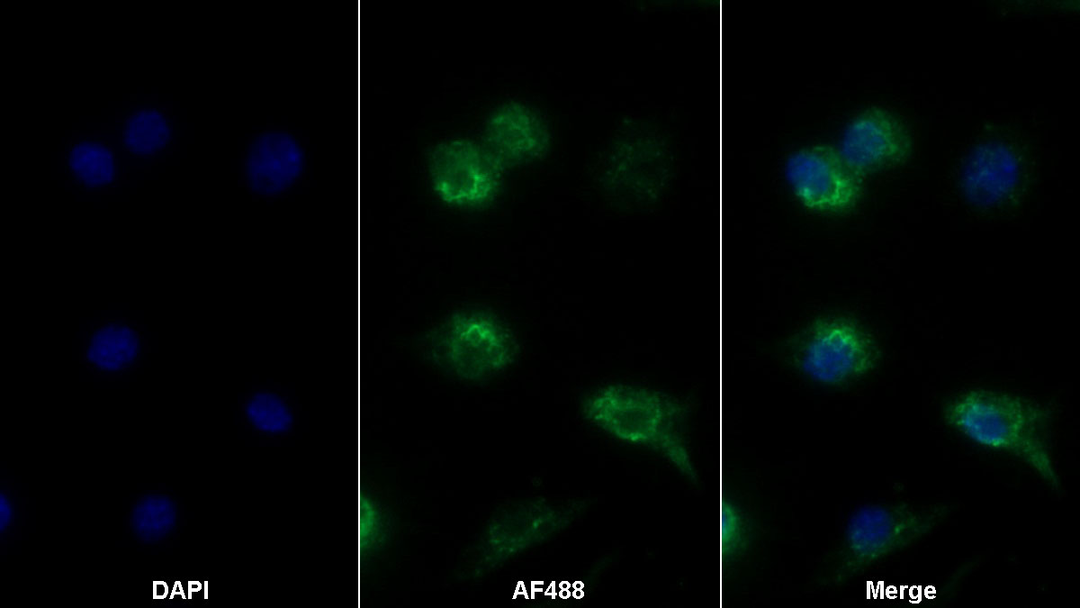 Monoclonal Antibody to Tumor Necrosis Factor Alpha (TNFa)