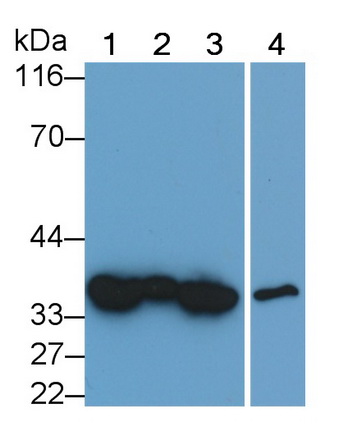 Monoclonal Antibody to Annexin V (ANXA5)