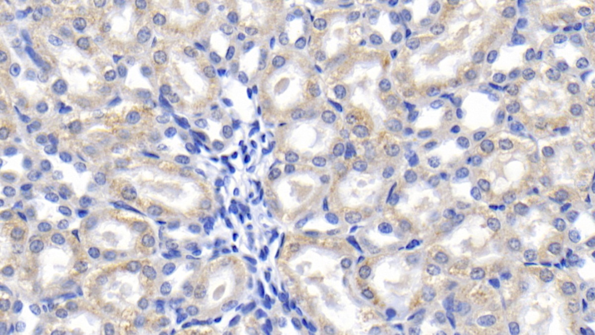Monoclonal Antibody to Galectin 1 (GAL1)