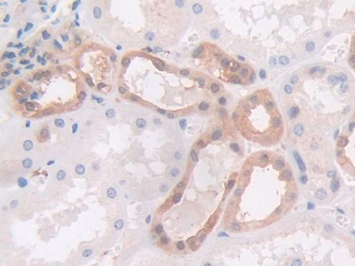 Monoclonal Antibody to Gelsolin (GSN)