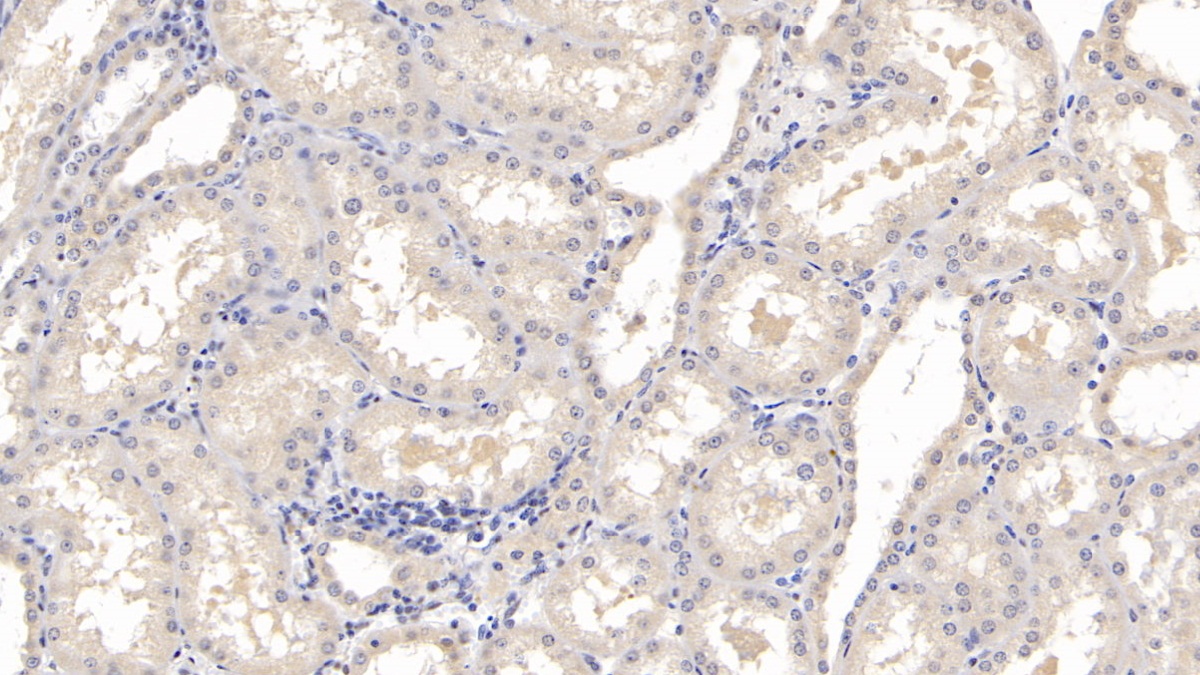 Monoclonal Antibody to Gelsolin (GSN)