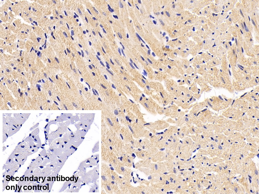 Monoclonal Antibody to Desmin (Des)