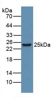 Monoclonal Antibody to High Mobility Group Protein 1 (HMGB1)
