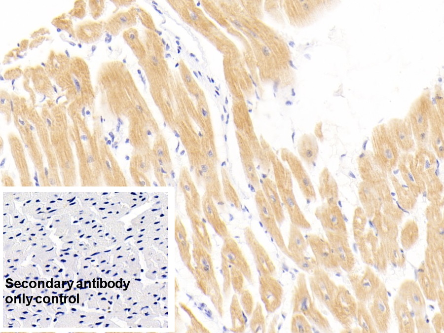 Monoclonal Antibody to Cardiac Troponin I (cTnI)