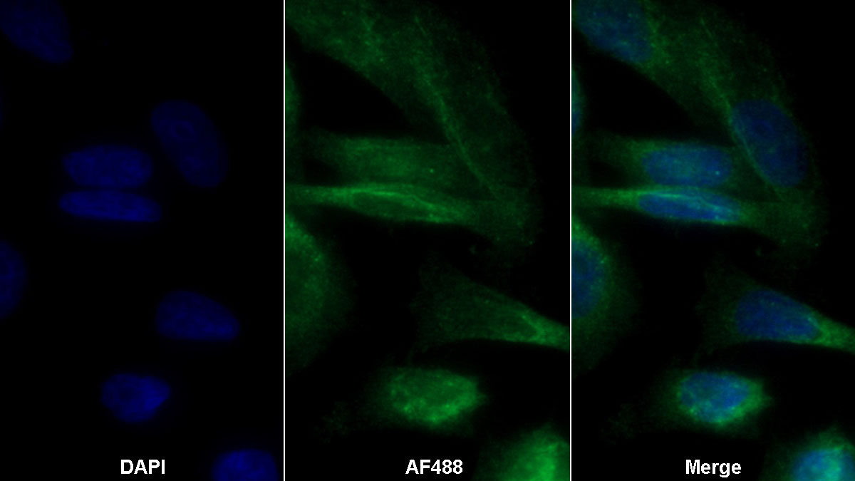 Monoclonal Antibody to Ferritin (FE)