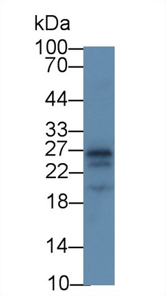 Monoclonal Antibody to Apolipoprotein A1 (APOA1)