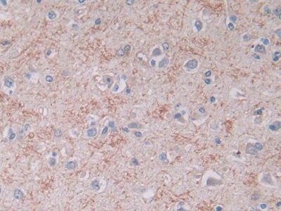 Monoclonal Antibody to Brain Natriuretic Peptide (BNP)