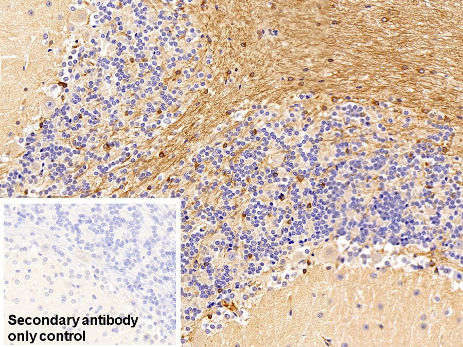 Monoclonal Antibody to Immunoglobulin G (IgG)