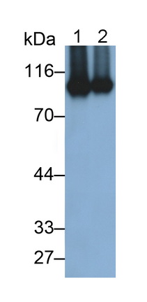 Monoclonal Antibody to Matrix Metalloproteinase 9 (MMP9)