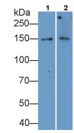 Monoclonal Antibody to Procollagen III N-Terminal Propeptide (PIIINP)