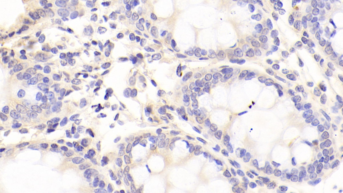 Monoclonal Antibody to Procalcitonin (PCT)