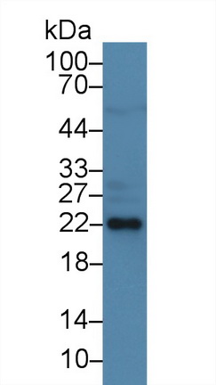 Monoclonal Antibody to Heat Shock Protein 27 (Hsp27)
