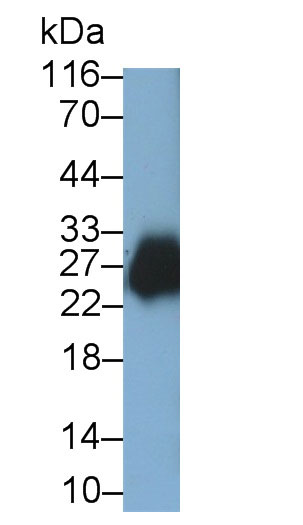 Monoclonal Antibody to Prostaglandin-H2 D-isomerase (PTGDS)