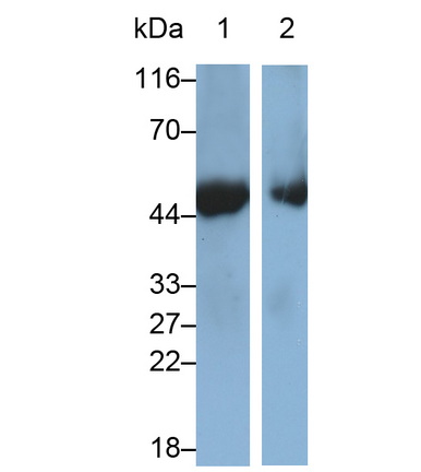 Monoclonal Antibody to Cluster Of Differentiation 38 (CD38)