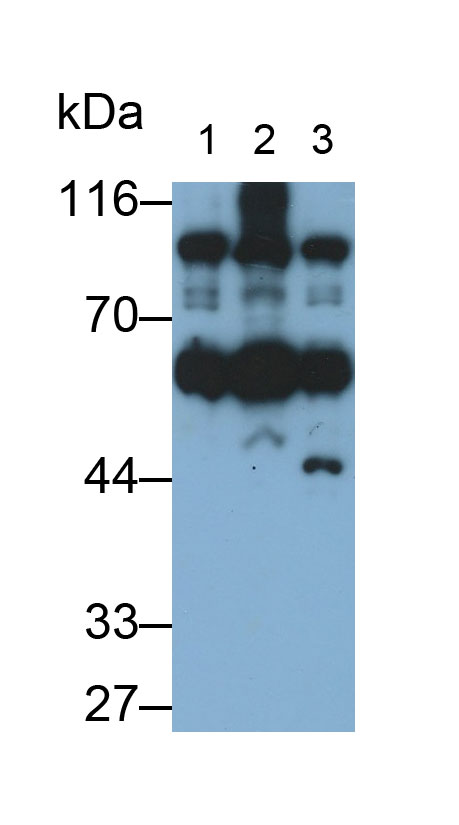 Monoclonal Antibody to Hexokinase 1 (HK1)
