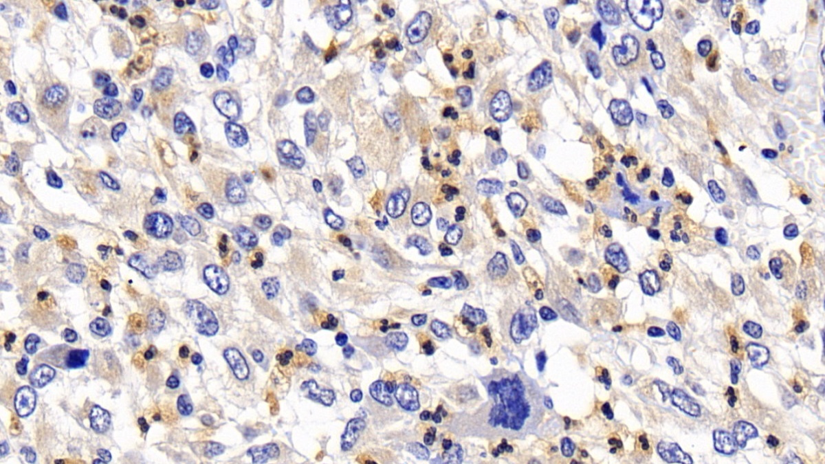 Monoclonal Antibody to B-Cell Leukemia/Lymphoma 2 (Bcl2)