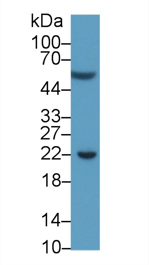 Monoclonal Antibody to Programmed Cell Death Protein 1 Ligand 1 (PDL1)