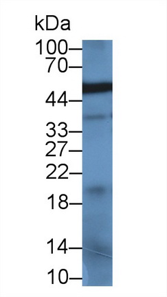 Monoclonal Antibody to Alpha-1-Acid Glycoprotein (a1AGP)