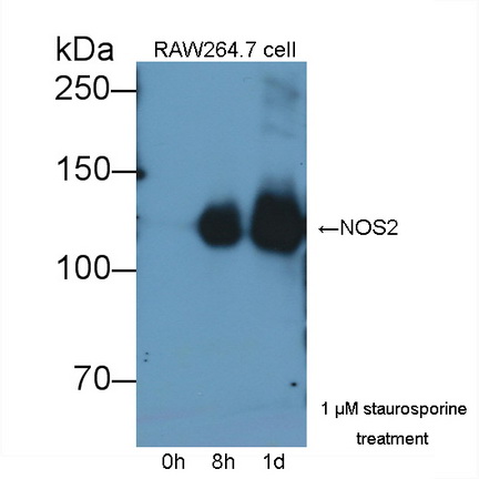 Monoclonal Antibody to Nitric Oxide Synthase 2, Inducible (NOS2)