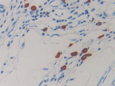 Monoclonal Antibody to Resistin (RETN)
