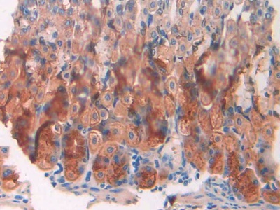 Monoclonal Antibody to Resistin (RETN)