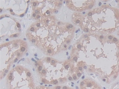 Monoclonal Antibody to Cyclophilin A (CYPA)