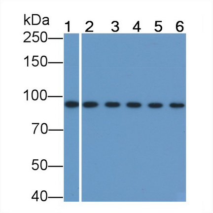 Monoclonal Antibody to Beta Catenin (β-catenin)
