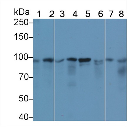 Monoclonal Antibody to Beta Catenin (β-catenin)