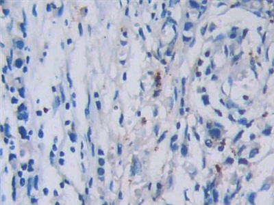 Monoclonal Antibody to Tryptase (TPS)