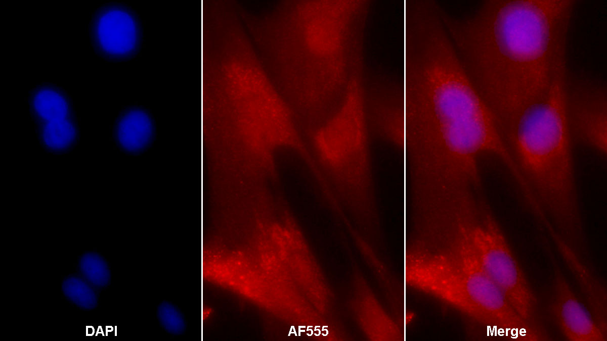 Monoclonal Antibody to Alkaline Phosphatase, Tissue-nonspecific (ALPL)
