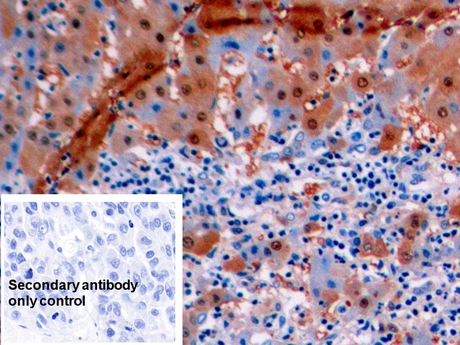 Monoclonal Antibody to Arginase (ARG)
