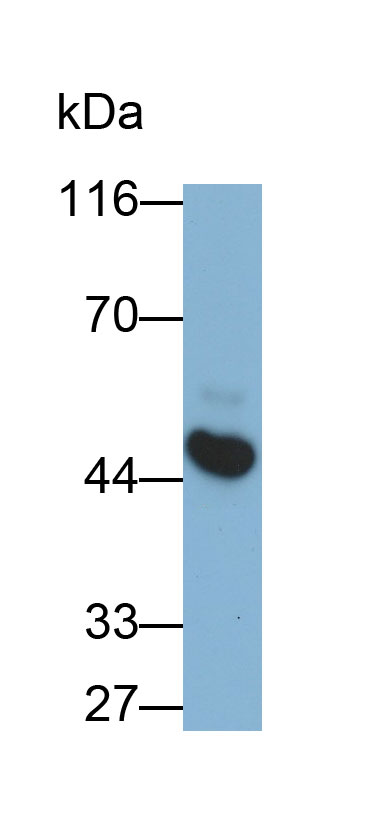 Monoclonal Antibody to Cytokeratin Fragment Antigen 21-1 (CYFRA21-1)