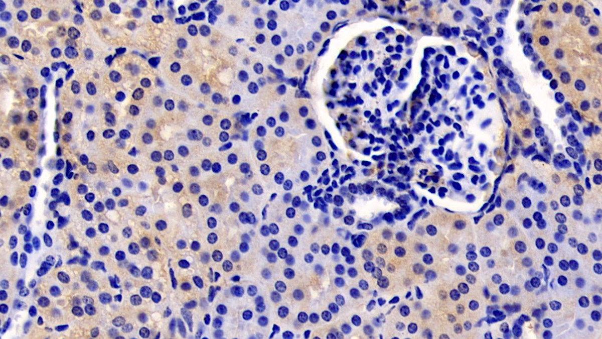 Monoclonal Antibody to Thymic Stromal Lymphopoietin (TSLP)