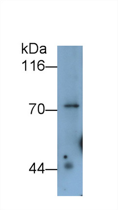 Monoclonal Antibody to Cadherin 5 (CDH5)