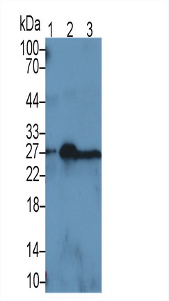Monoclonal Antibody to Neutrophil gelatinase-associated lipocalin (NGAL)