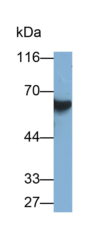 Monoclonal Antibody to Salivary Alpha Amylase (AMY1A)