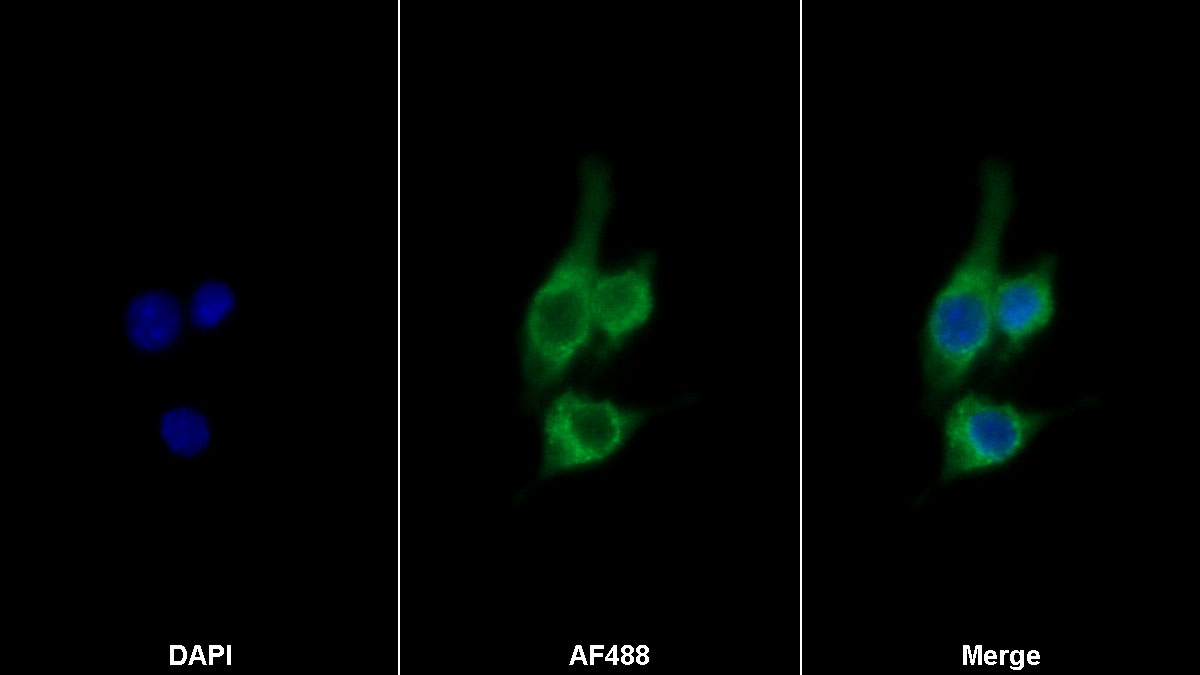 Monoclonal Antibody to Colony Stimulating Factor Receptor, Macrophage (MCSFR)