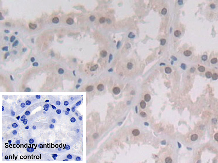 Monoclonal Antibody to Cytosolic Phospholipase A2 (PLA2G4)