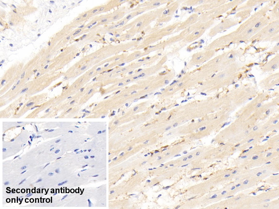 Monoclonal Antibody to Fatty Acid Binding Protein 4 (FABP4)