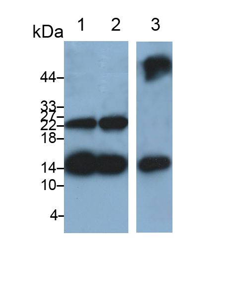 Monoclonal Antibody to Fatty Acid Binding Protein 4 (FABP4)