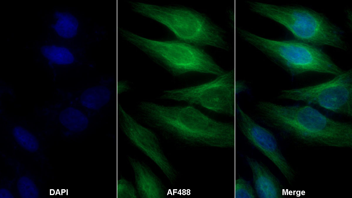 Monoclonal Antibody to Fibroblast Growth Factor Receptor 3 (FGFR3)
