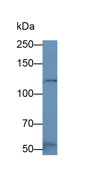 Monoclonal Antibody to Vinculin (VCL)