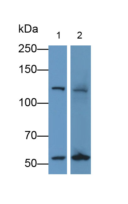 Monoclonal Antibody to Vinculin (VCL)