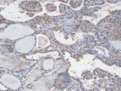 Monoclonal Antibody to Vascular Endothelial Growth Factor 121 (VEGF121)
